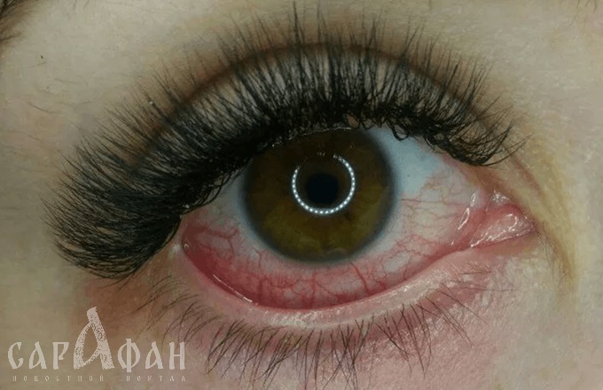 В Майкопе дети получили ожоги глаз