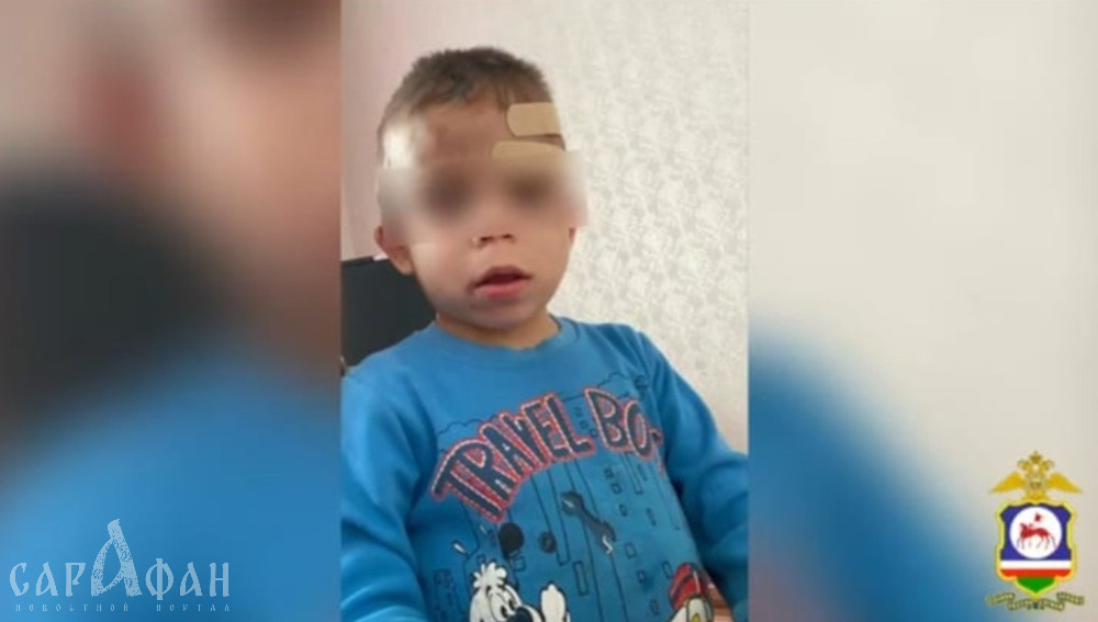 «Никто из соседей даже не подозревал о его существовании»: испещренный ранами и истощенный голодом мальчишка с самого рождения жил на привязи в четырех стенах