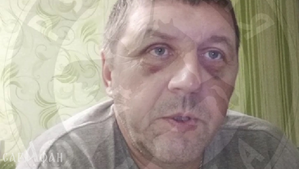 Оскорбляли русских женщин: жестоко избитый подростками-мигрантами мужчина опасается, что их родные могут «замять дело»