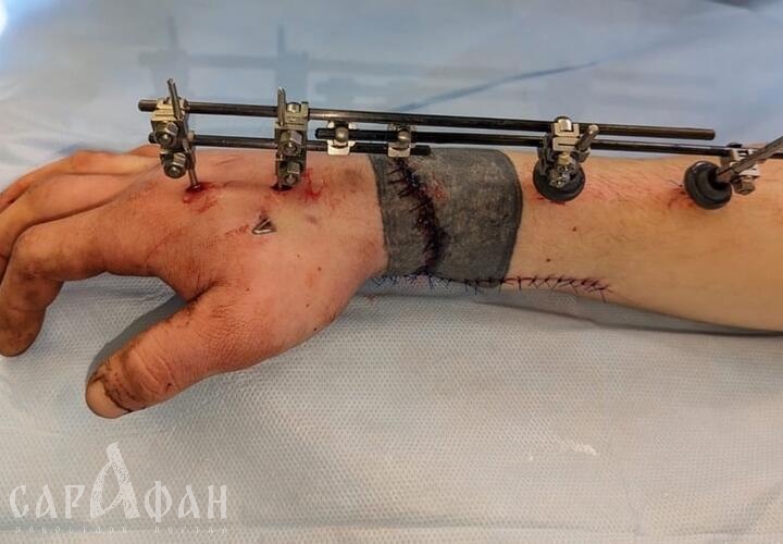 Кубанские хирурги «пришили» 22-летнему парню руку