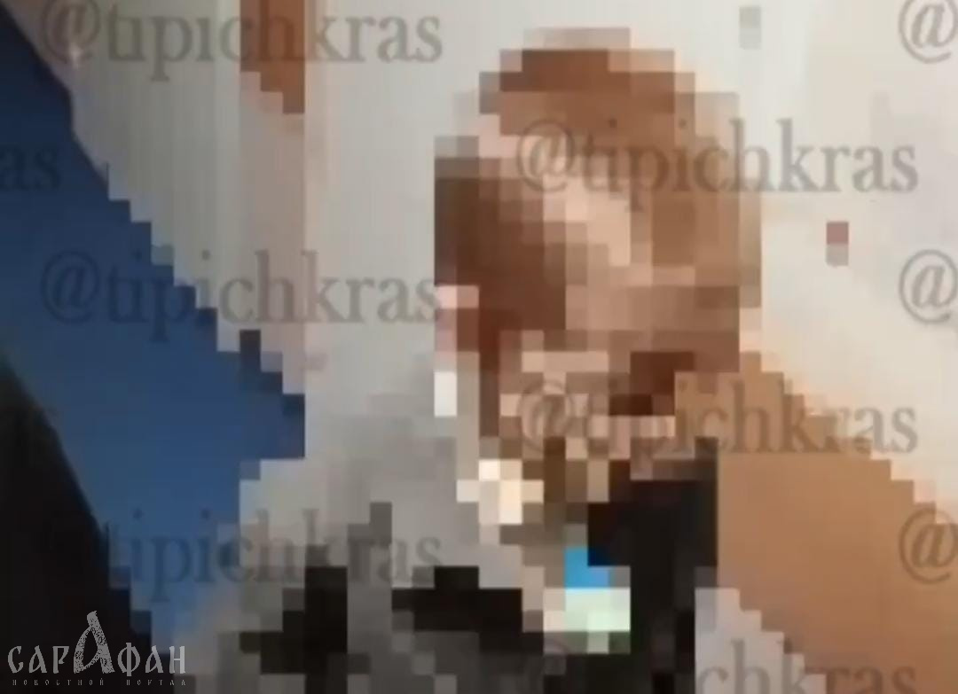 Появилось видео с маленьким Валей, которому растерзали лицо сорвавшиеся с цепи собаки