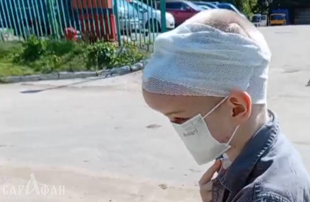 Будут жить на пособия: растерзанному собаками мальчику из Сочи оформили инвалидность, а отец сам отправил себя в вечный отпуск