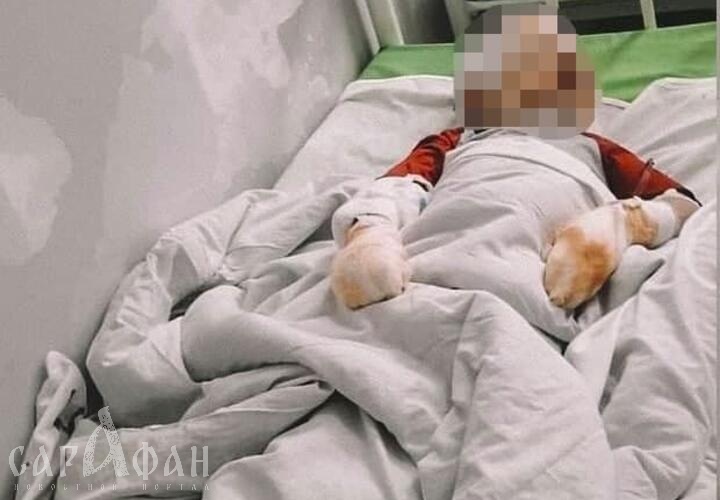В Крыму малыш попал в больницу с обширными ожогами