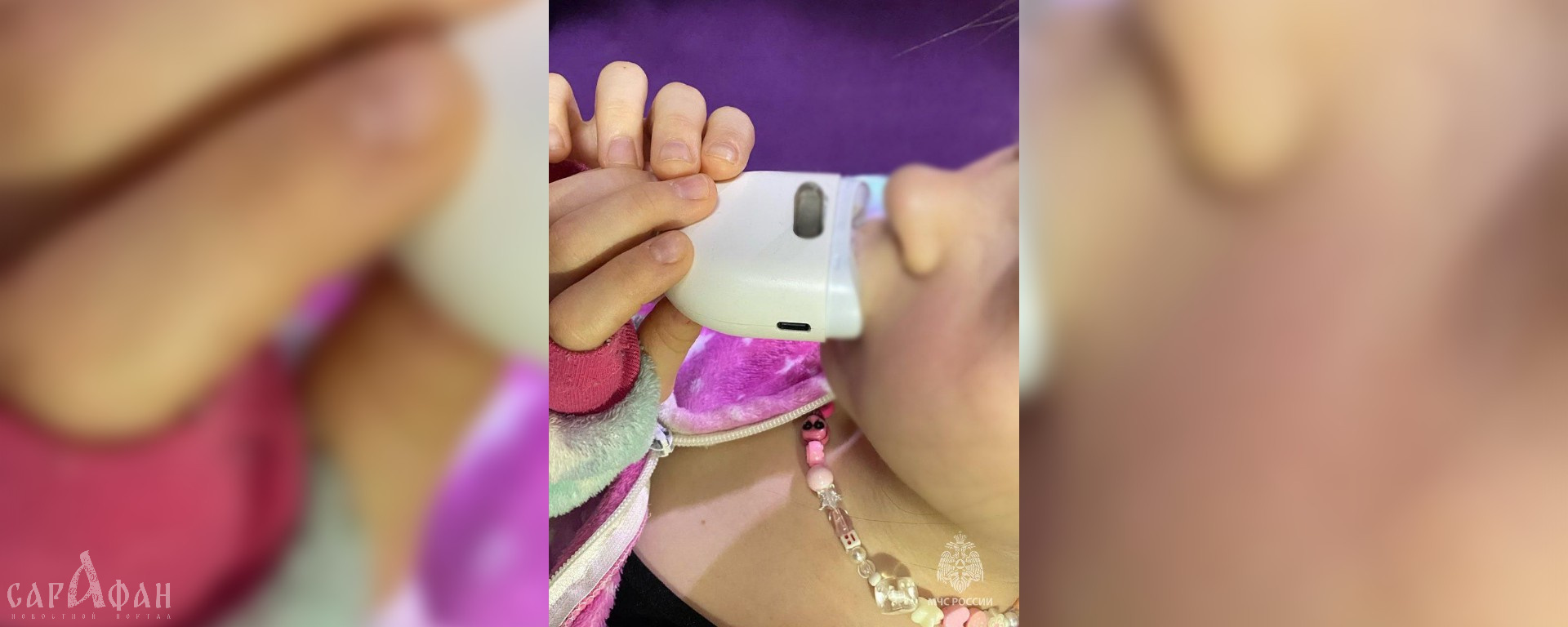 Губу 9-летней школьницы зажевало машинкой для стрижки ногтей в Сочи
