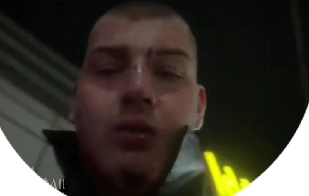 «Папа хочет решить вопрос тихо»: малолетний бандит со своей свитой изувечили невинного просто так, а влиятельный отец пытается «замять дело»