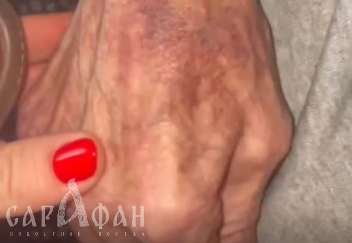 «Без сознания в инвалидном кресле и привязанный»: сдали деда в пансионат, но методы персонала шокировали 