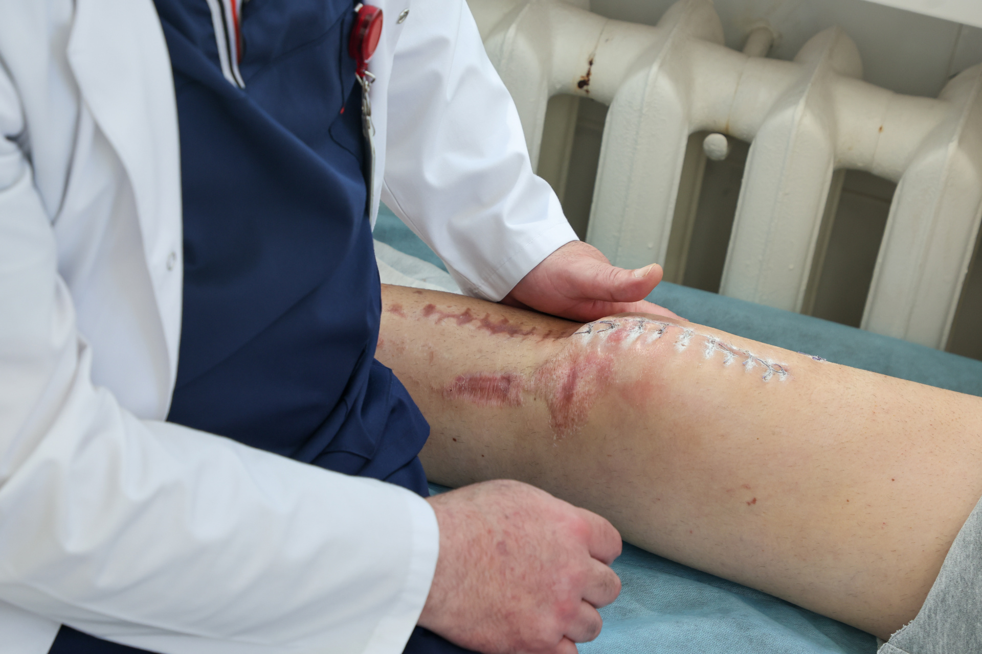 Волгоградец заплатит более полумиллиона рублей своей жертве, которую почти на год лишил ног 