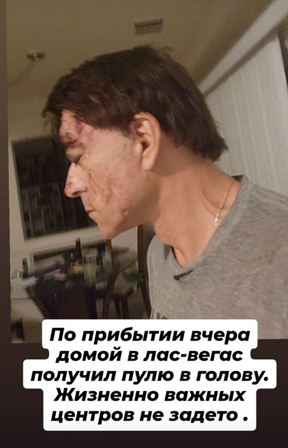 587x913_0xHug43qlj_6280841658617691834.jpg