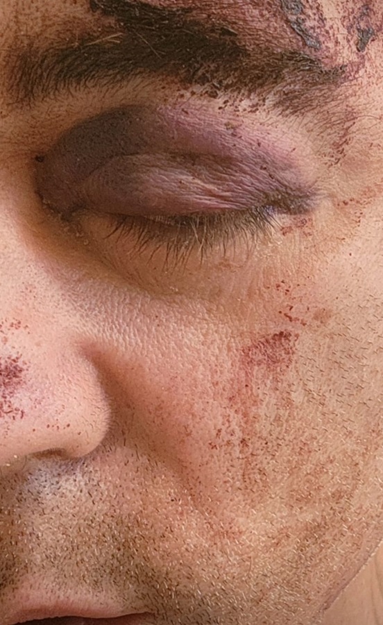 560x912_0xRiKgVkEn_8830798001532550518.jpg